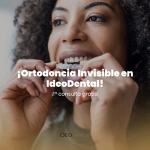 TARJETA DE PRESTACIONES IDEODENTAL DESDE 29,90€, CON MÁS DE 100 PRESTACIONES GRATUITAS.