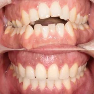 Diagnostico y planificación gratis. 10% de descuento en todos los tratamientos.